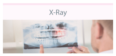 16_Xray.jpg 16_Xray.jpg