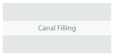 Canal_Filling.jpg