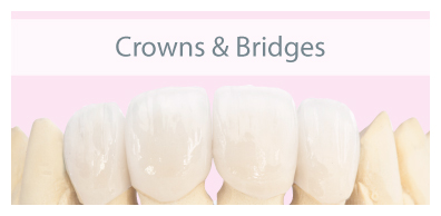 Crowns&amp;Bridges.jpg