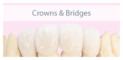 Crowns&Bridges.jpg Crowns&Bridges.jpg